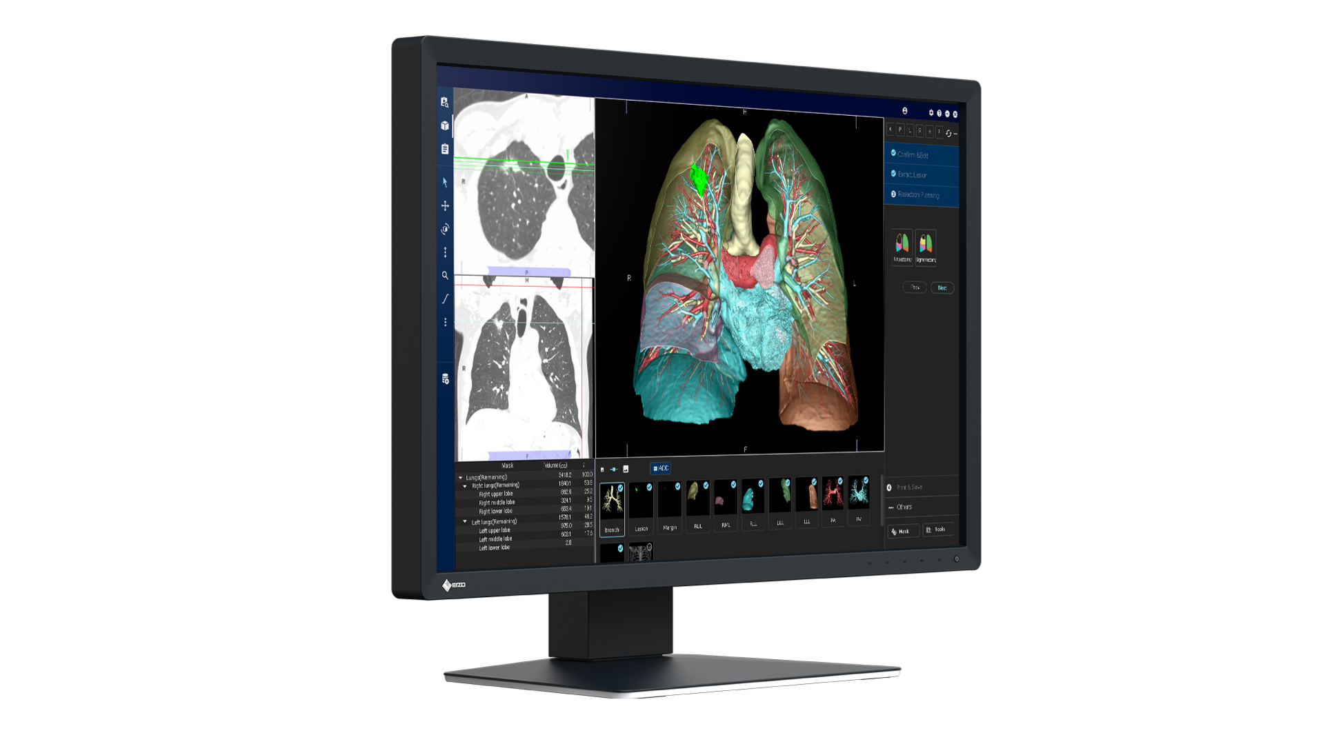 EIZO RadiForce MX243W computer monitor – image 8