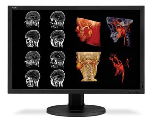 NEC MD304MC computer monitor