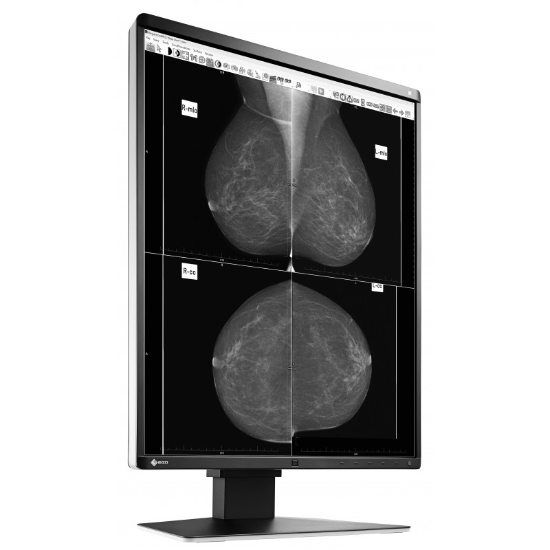 EIZO RadiForce GX560 computer monitor – image 4