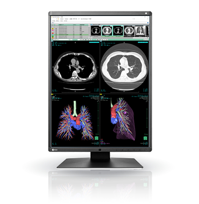EIZO RadiForce RX360 computer monitor – image 6