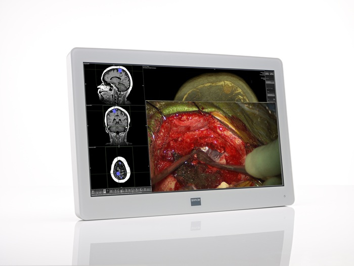 Barco MDSC-2224 computer monitor