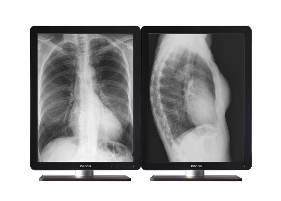 Barco MDCG-3221 computer monitor – image 3