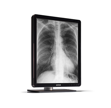 Barco MDCG-3221 computer monitor – image 1