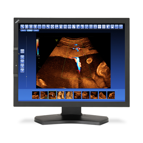 NEC MD210C2 computer monitor