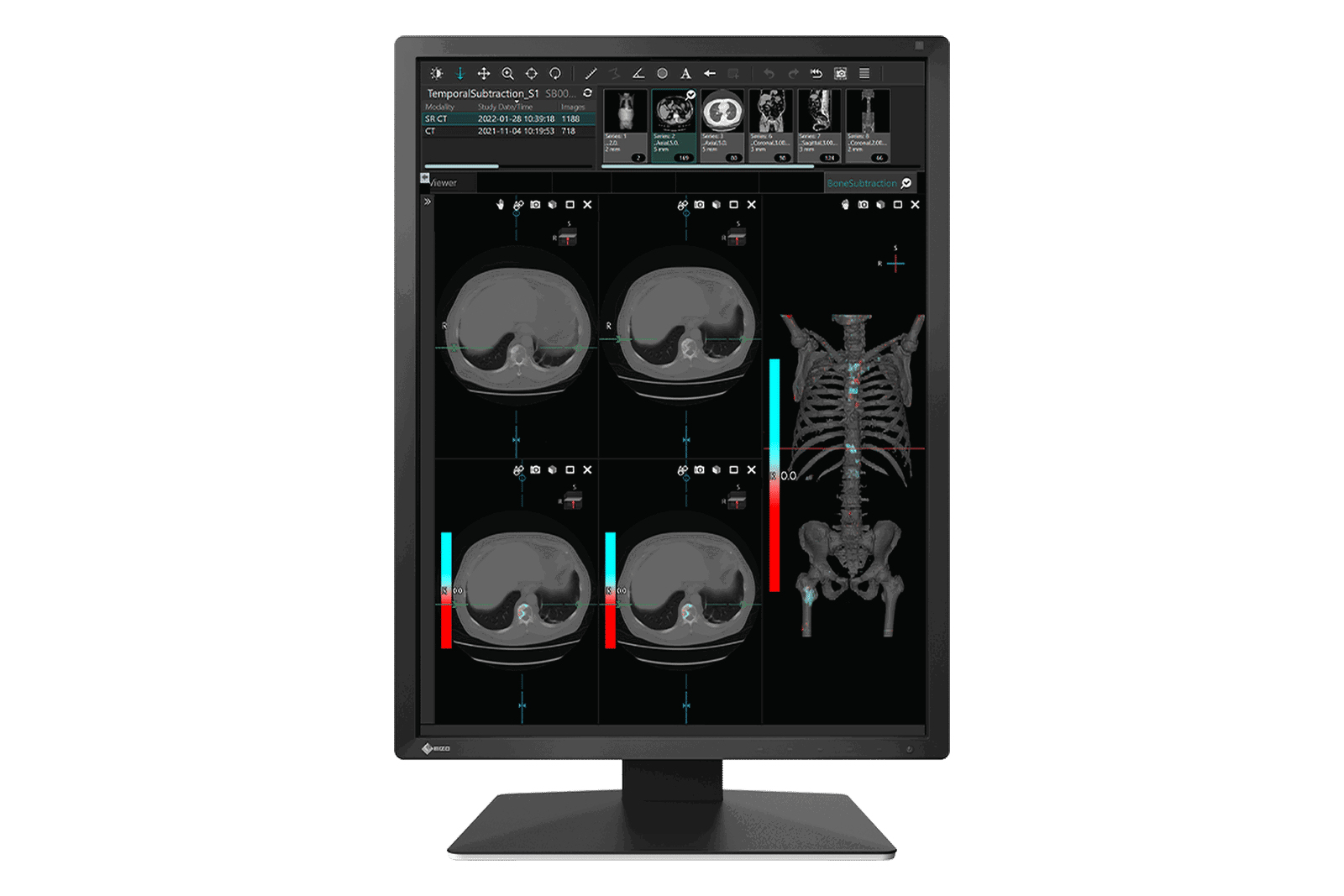 EIZO RadiForce MX217-BK computer monitor – image 1