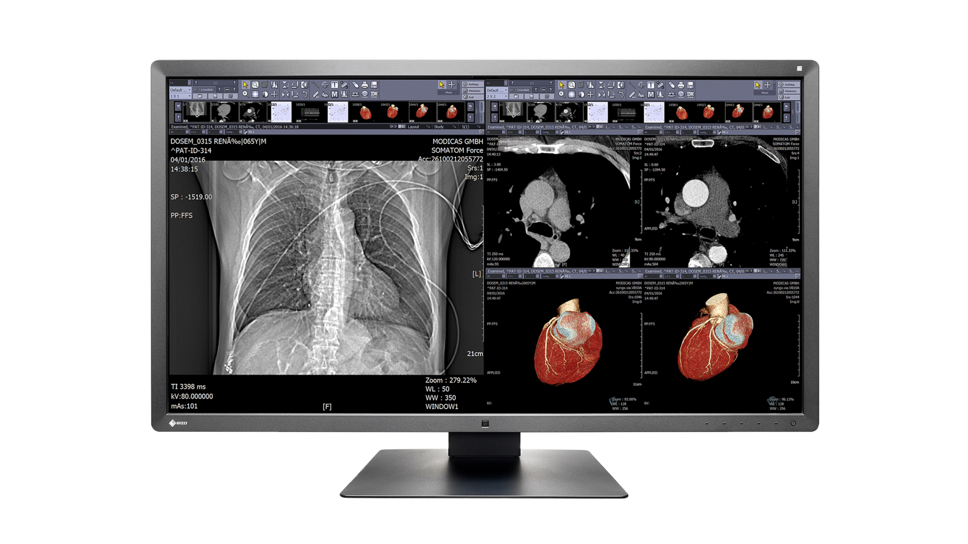 EIZO RadiForce MX315W computer monitor – image 1