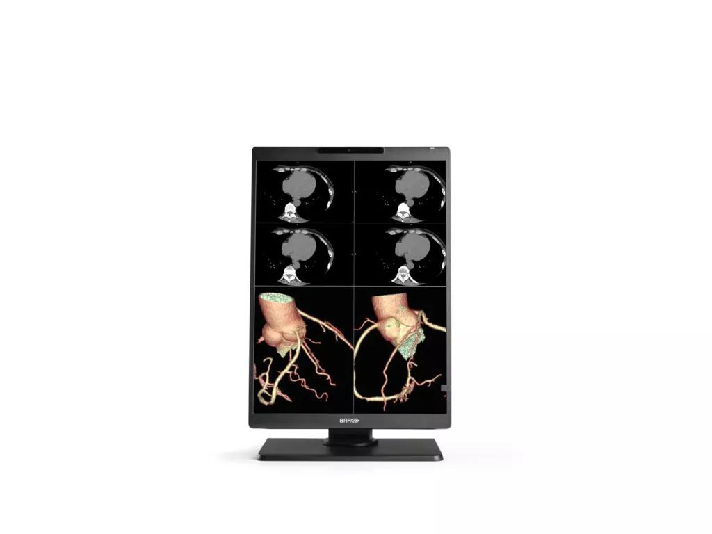 Barco MDNC‑2521 computer monitor – image 1