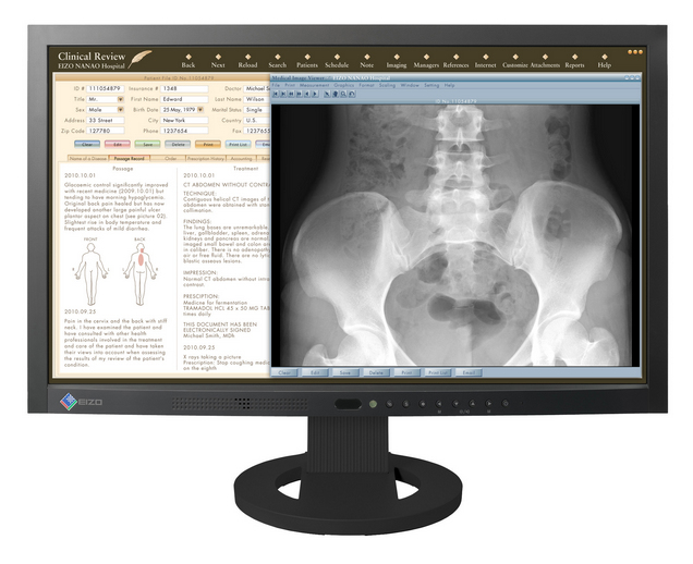 EIZO RadiForce MS230W 23" 