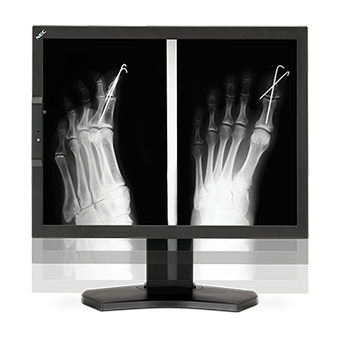 NEC MultiSync MD210C3 computer monitor – image 7