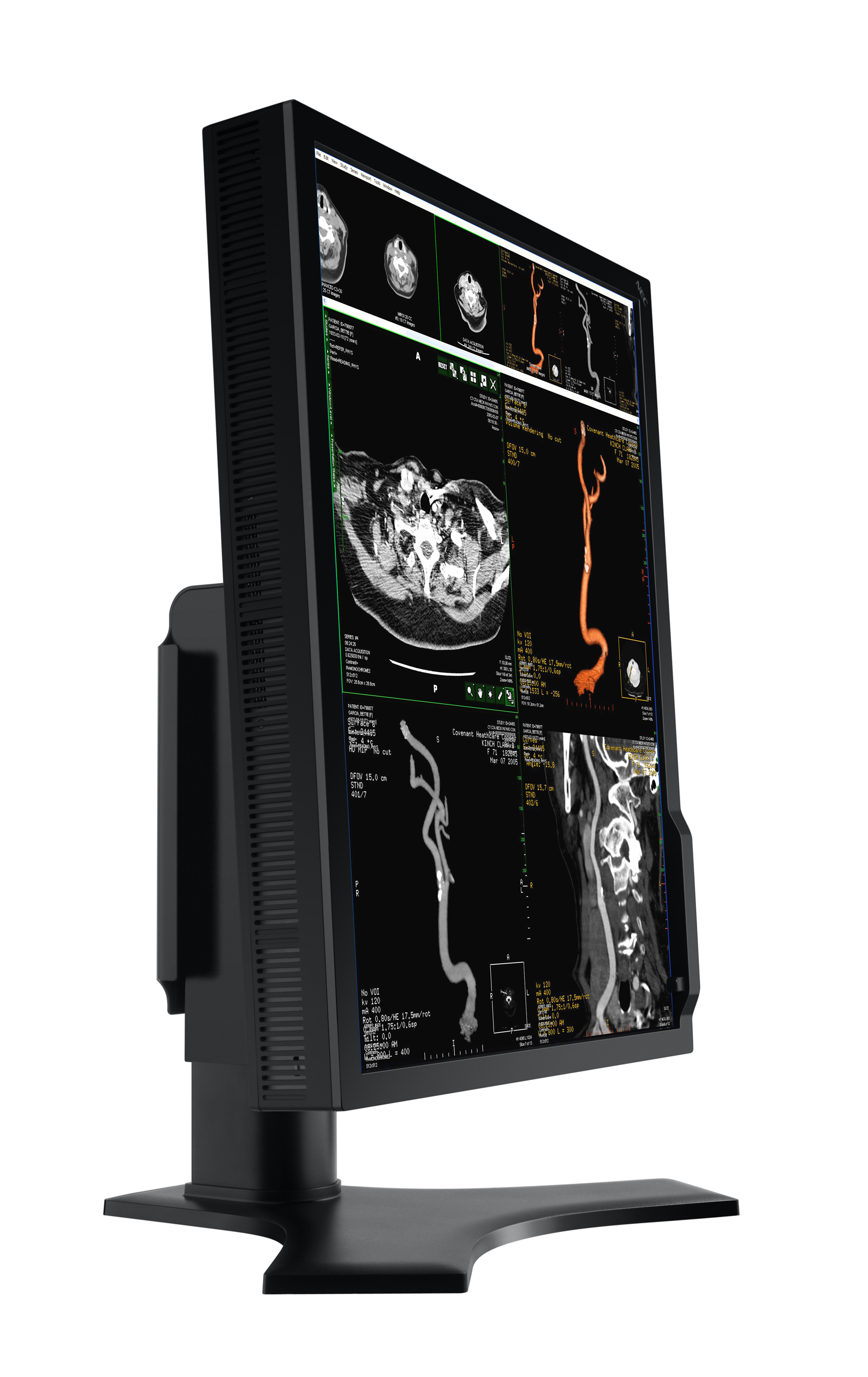 NEC MD213MC computer monitor – image 6