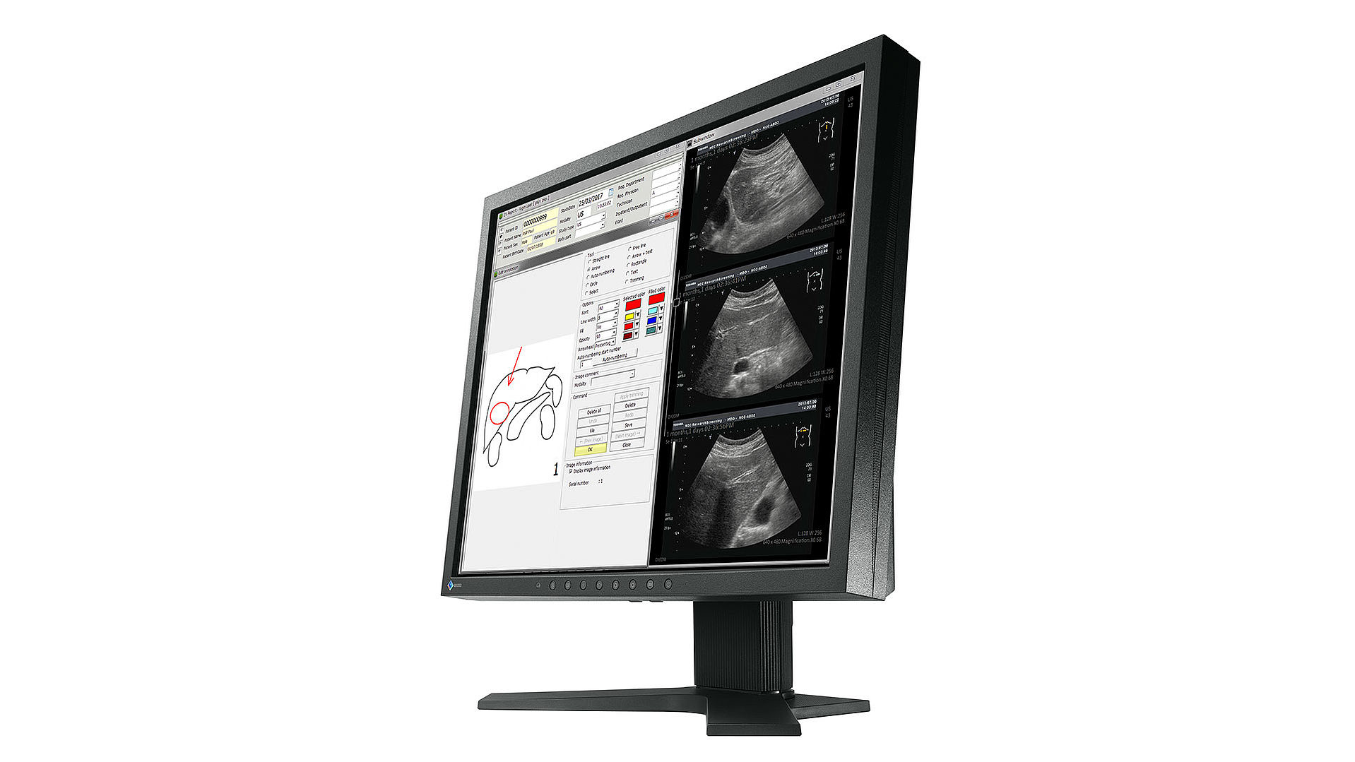 EIZO RadiForce MX194 computer monitor – image 3