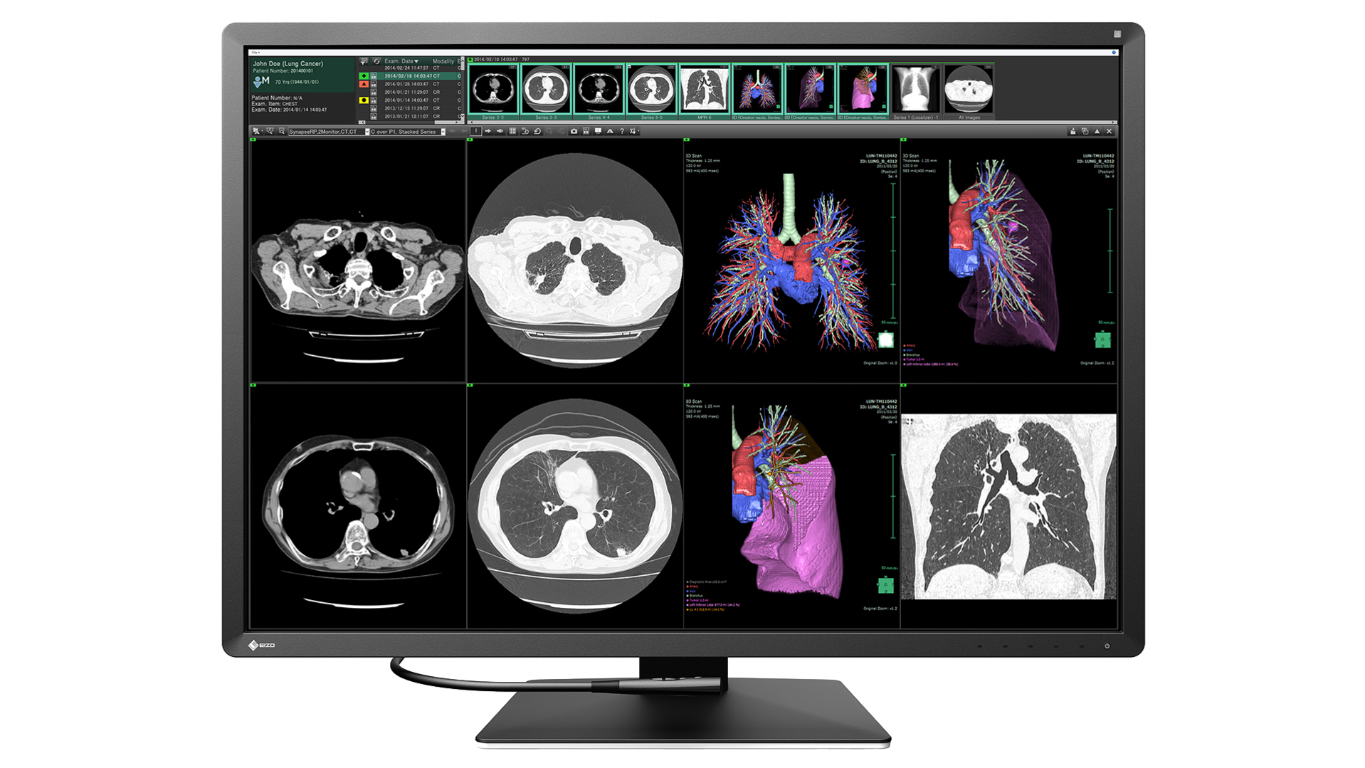 EIZO RadiForce RX1270 computer monitor – image 1