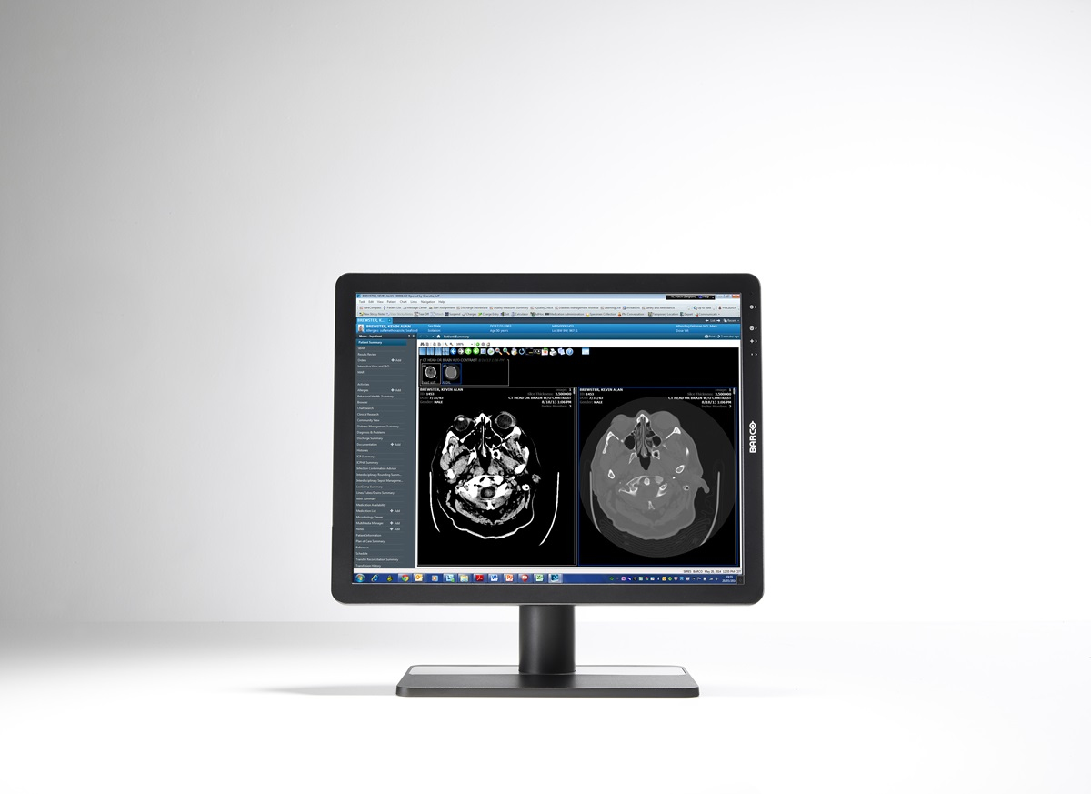 Barco MDRC-2221 computer monitor – image 4