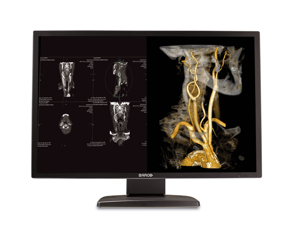Barco MDNC-4130 computer monitor