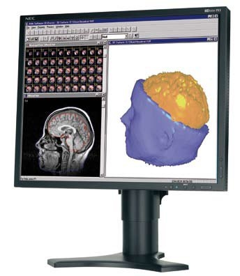NEC MDview 193