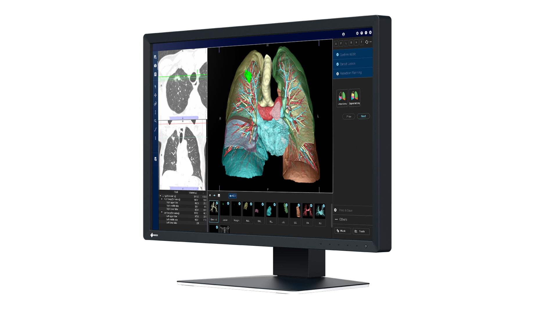 EIZO RadiForce MX243W computer monitor – image 2