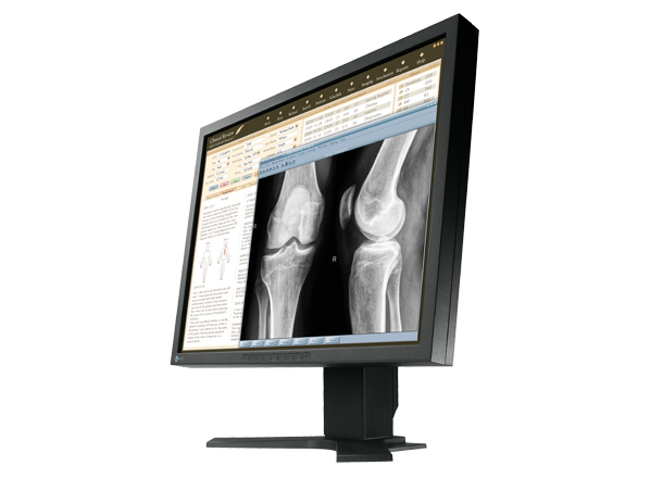 EIZO MX210 computer monitor – image 2