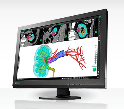 EIZO MX242W computer monitor – image 2