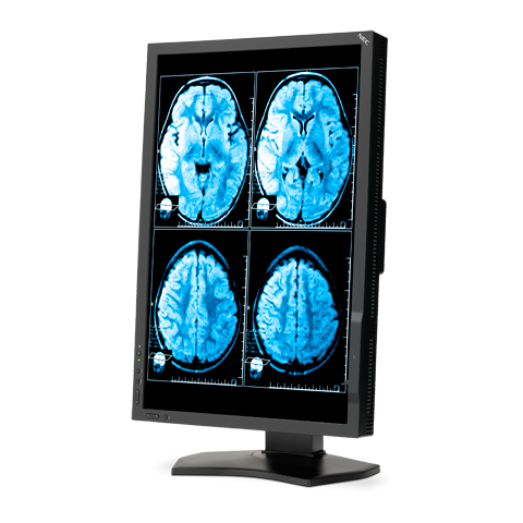 NEC MD242C2 computer monitor – image 4
