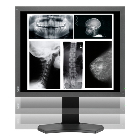 NEC MD215MG computer monitor – image 4