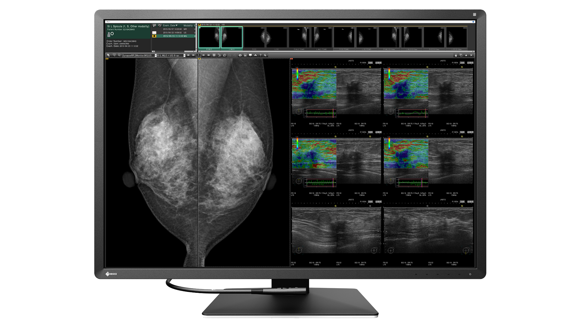 EIZO RadiForce RX1270 computer monitor – image 2