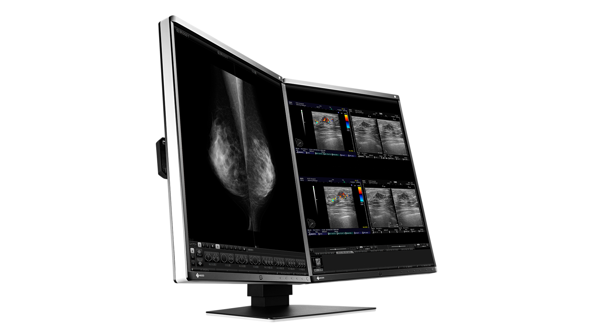 EIZO RadiForce RX560-MD computer monitor – image 5