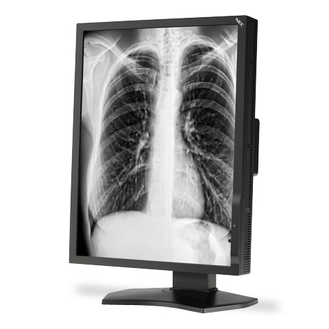 NEC MD211G3 computer monitor – image 1