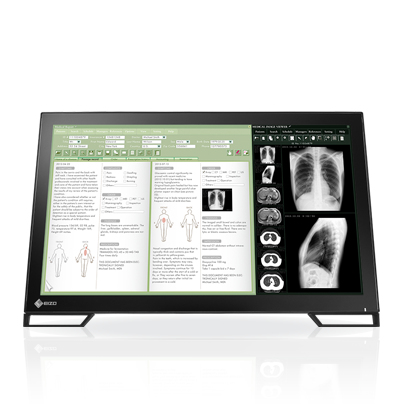 EIZO MS235WT computer monitor