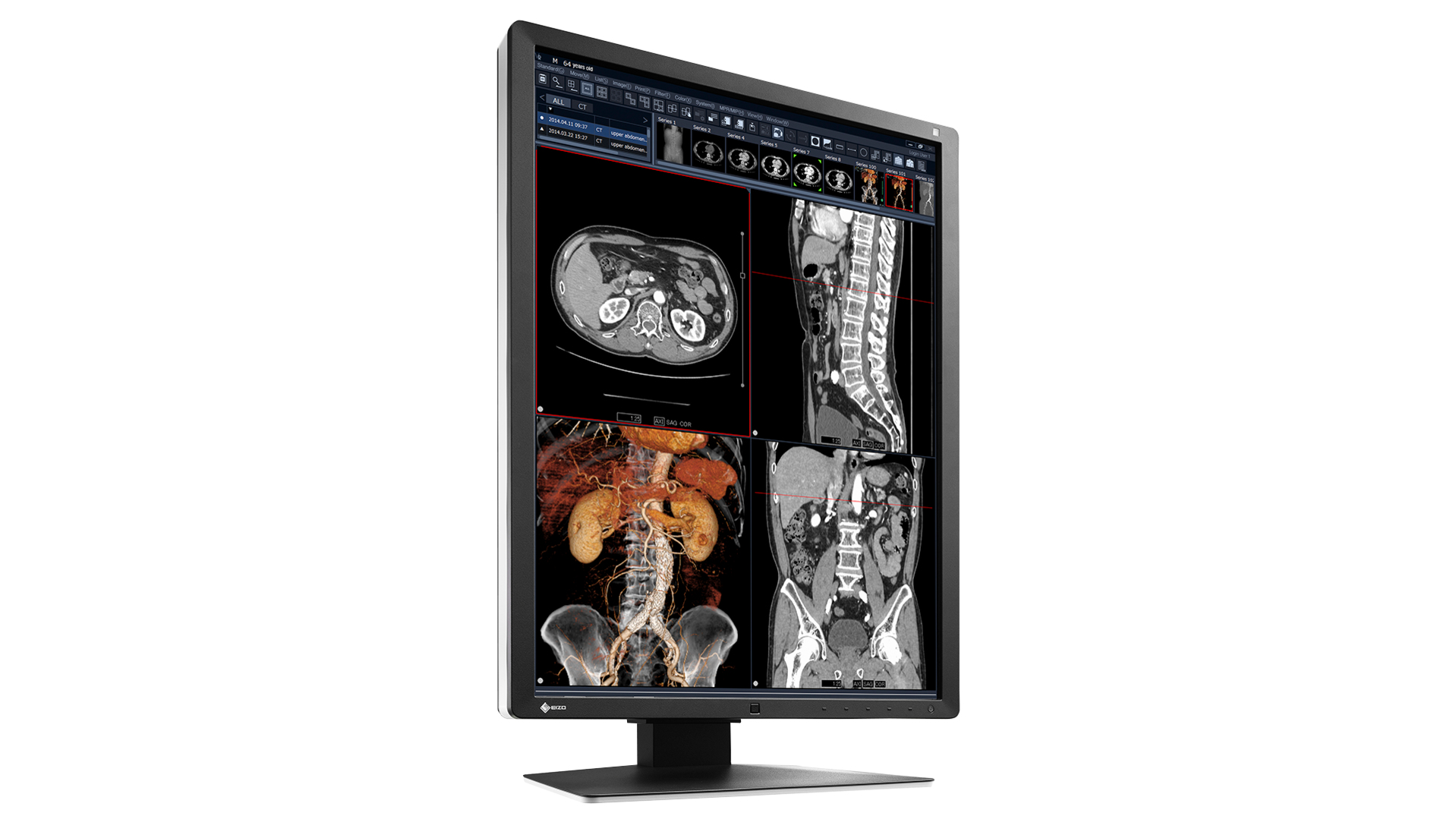 EIZO RadiForce RX250 computer monitor – image 3