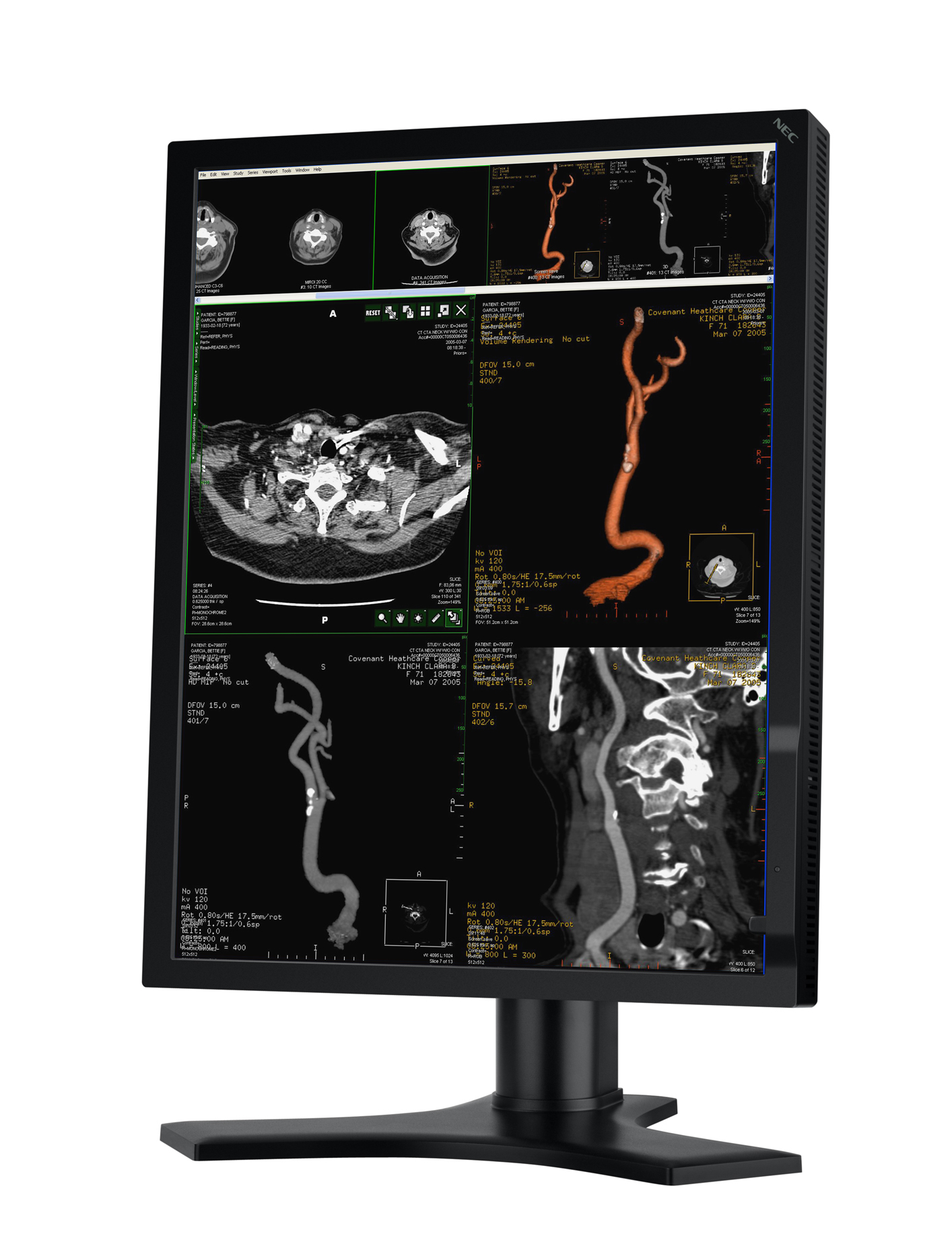 NEC MD213MC computer monitor – image 4