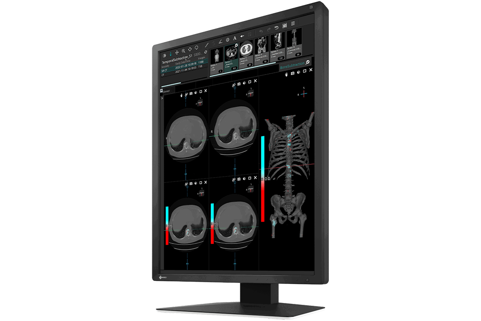 EIZO RadiForce MX217-BK computer monitor – image 2