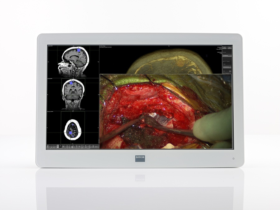 Barco MDSC-2224 computer monitor – image 2