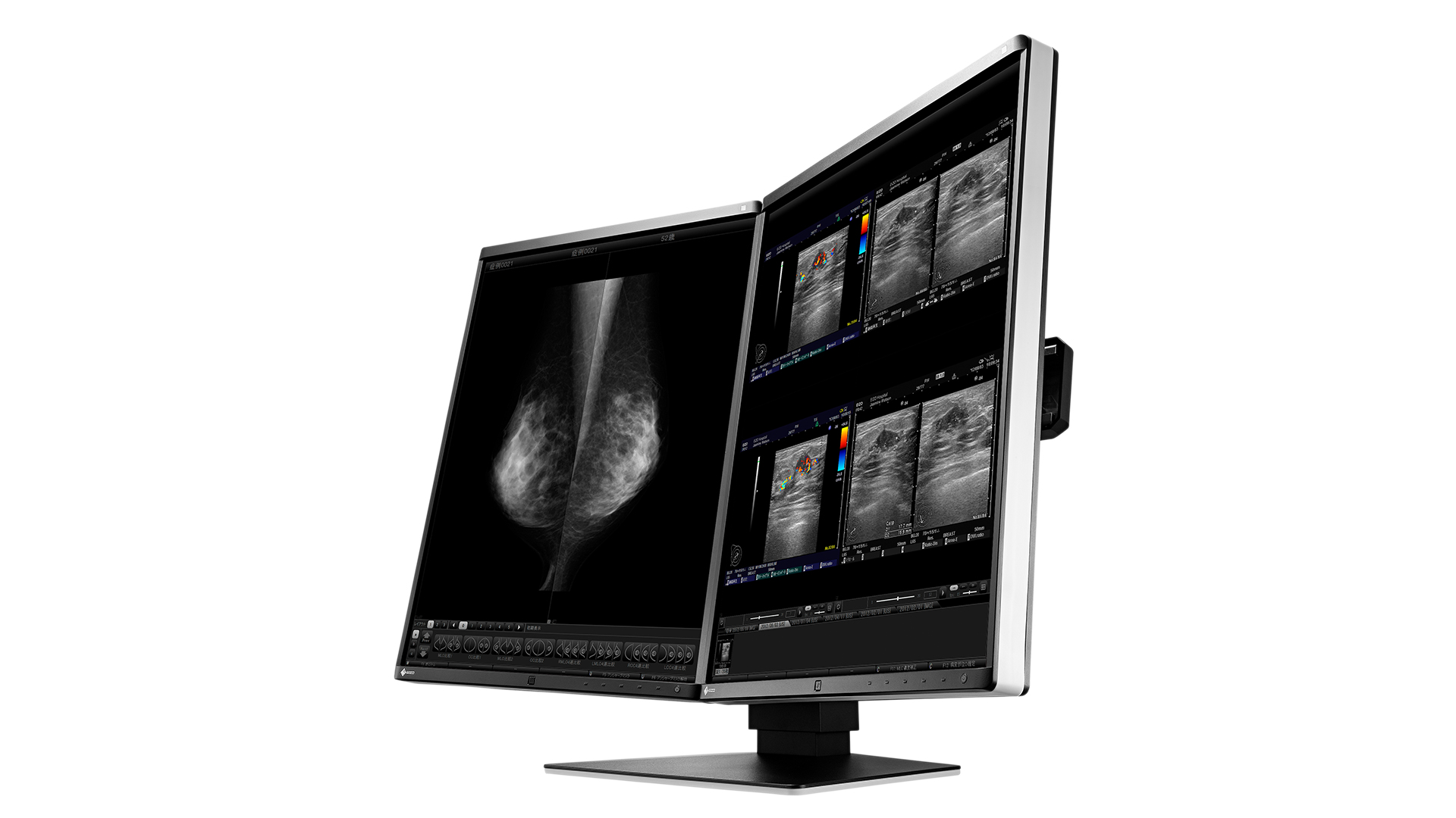 EIZO RadiForce RX560-MD computer monitor – image 3