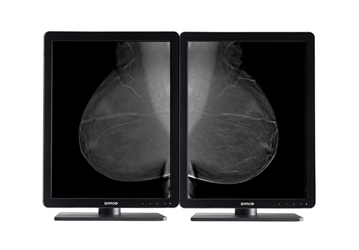 Barco Nio 5MP LED (MDNG-5221)