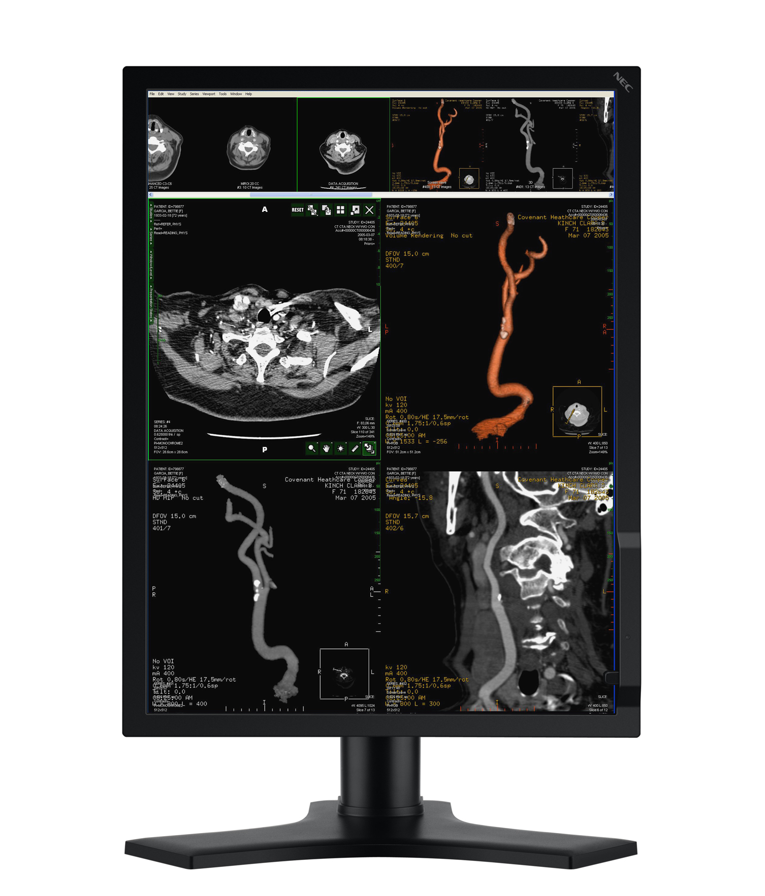 NEC MD213MC computer monitor – image 2