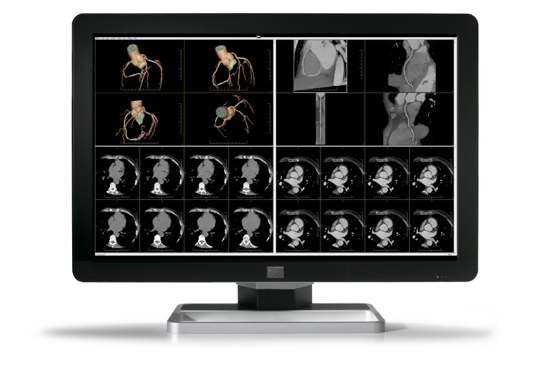 Barco MDCC-6430 computer monitor