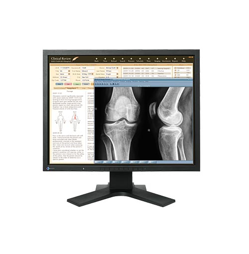EIZO RadiForce MX210