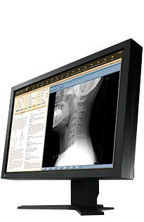EIZO MX240W computer monitor