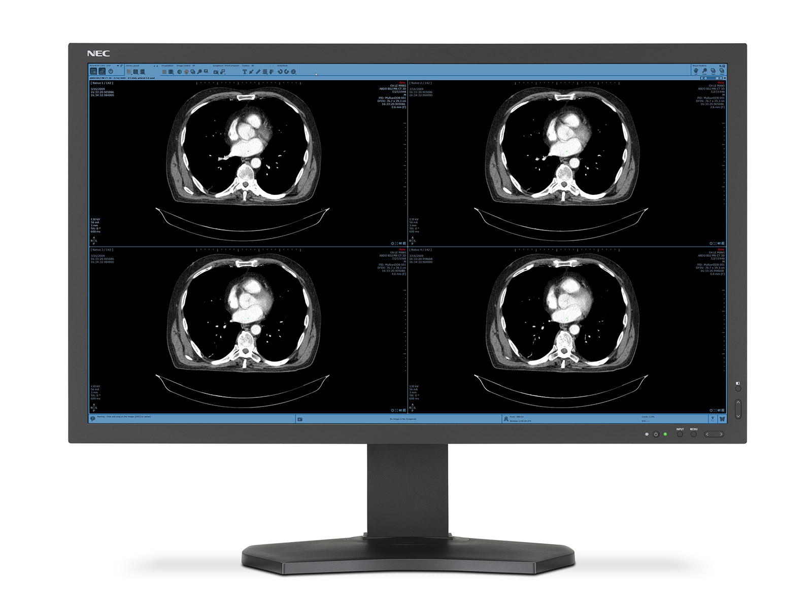 NEC MD322C8-2 computer monitor – image 2