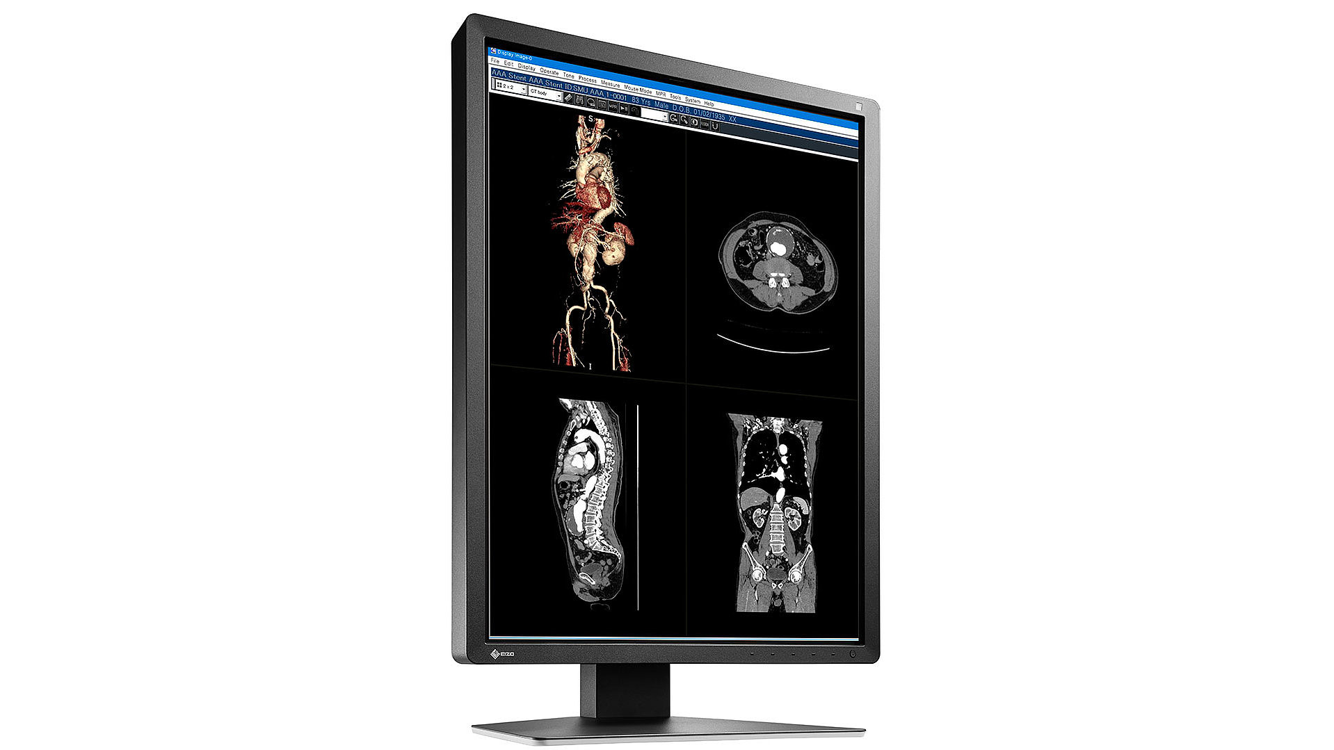 EIZO RadiForce MX216-SB computer monitor – image 8