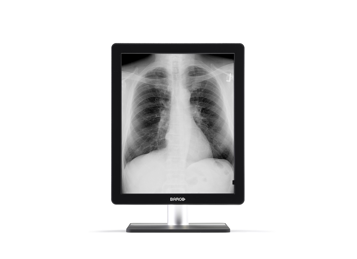 Barco MDCG-5221 computer monitor – image 3