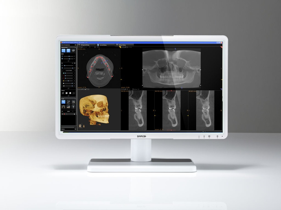Barco MDRC-2122 WP – image 2