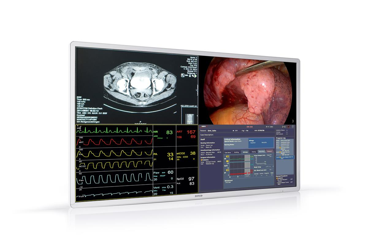 Barco MDSC-8255 computer monitor – image 1