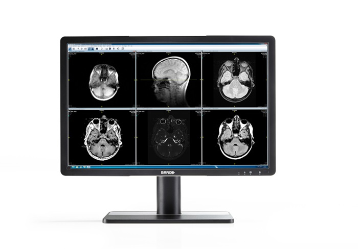 Barco Eonis 22" (MDRC-2122, Option TS)