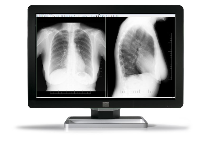 Barco MDCC-6430 computer monitor – image 2