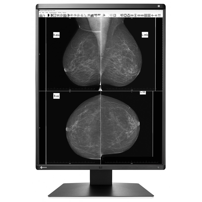 EIZO RadiForce GX560 computer monitor