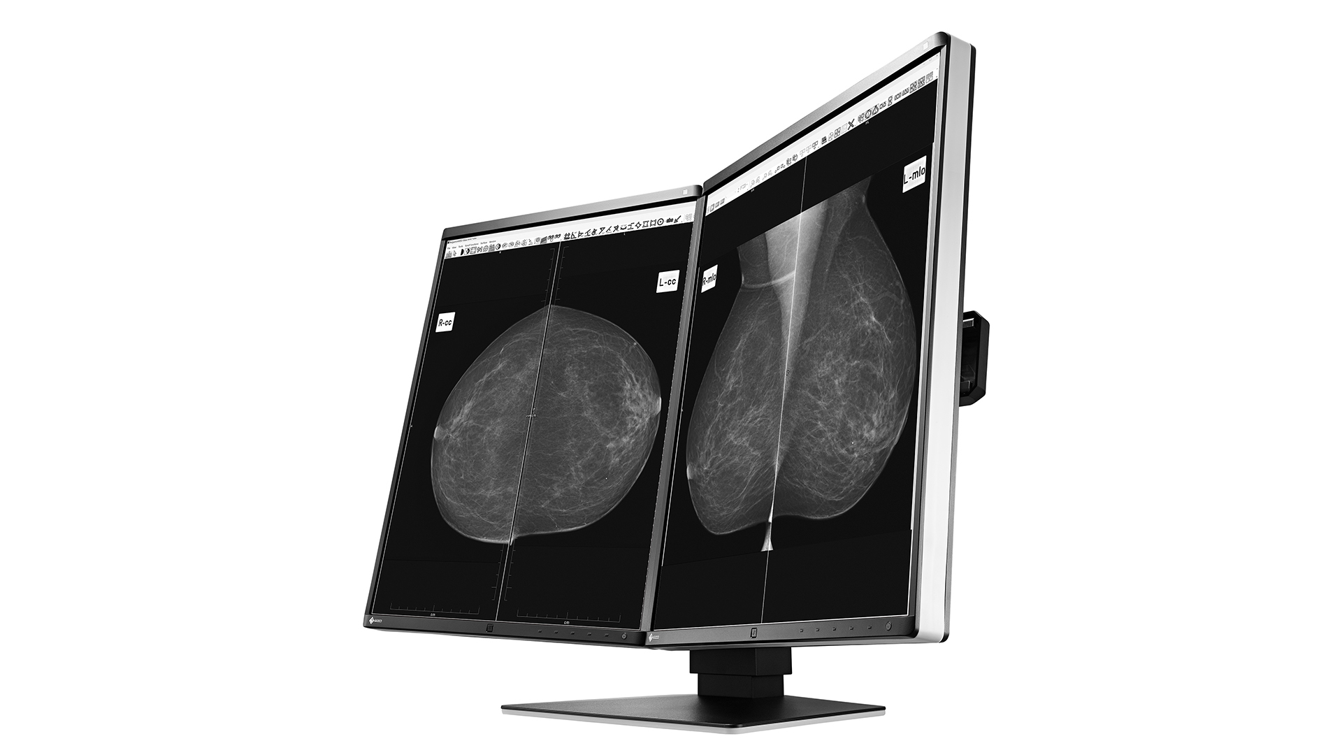 EIZO RadiForce GX560-MD computer monitor – image 4