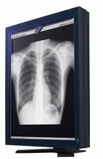 EIZO MED3MP-PPP graphics card GDDR – image 2
