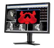 NEC MDview 242-2