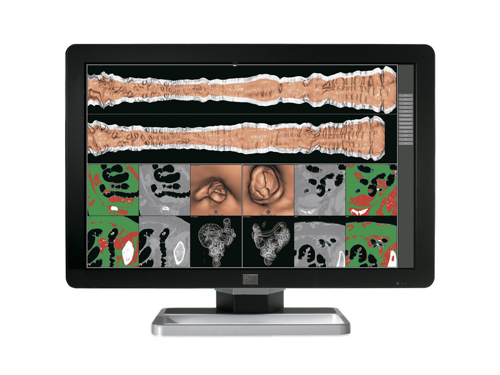 Barco MDCC-6130 computer monitor